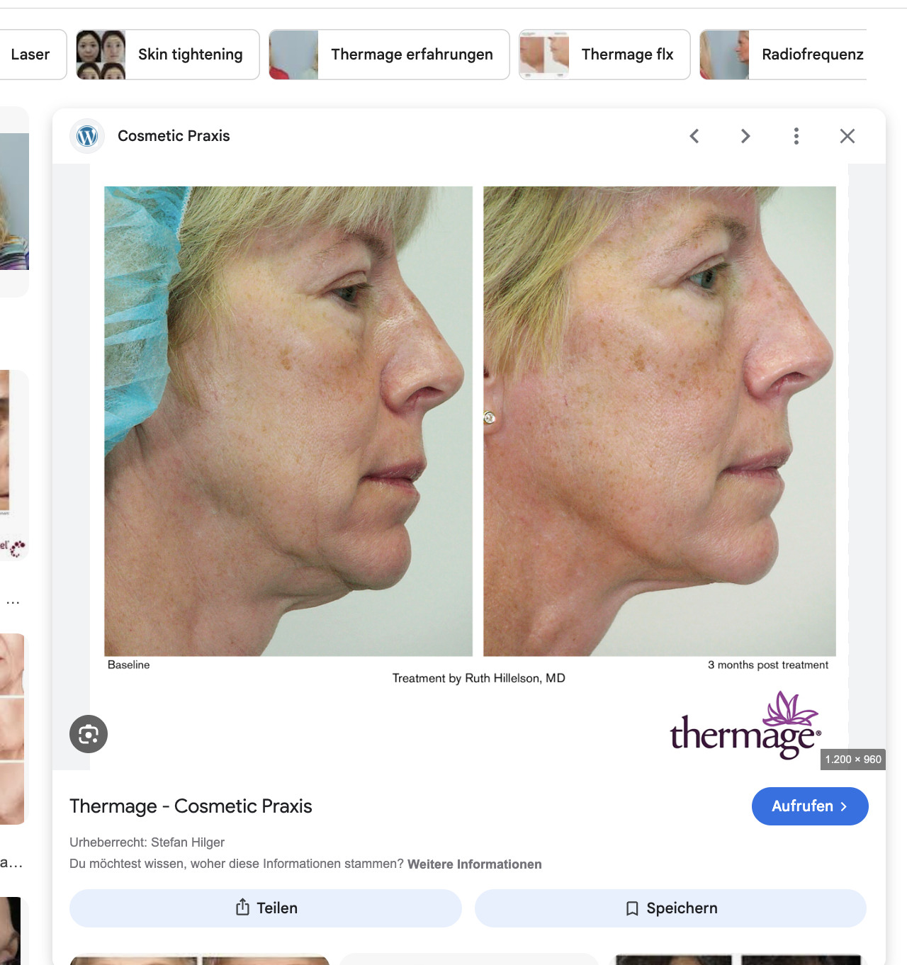 Wange, Jawline & Hals, Seitenprofil