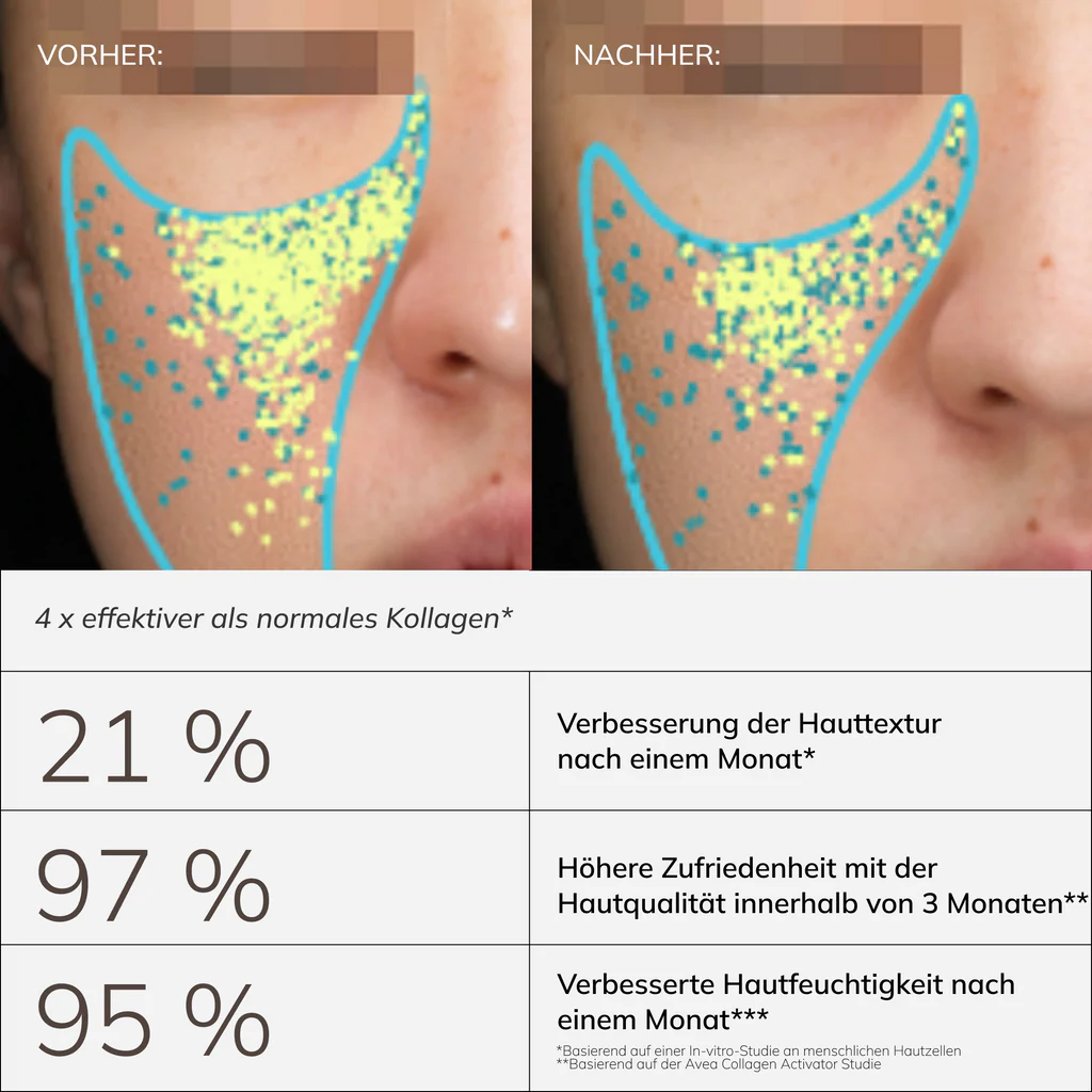 AVEA Collagen Activator Vorher Nachher Vergleich: 21 Prozent Verbesserung der Hauttextur, 97 Prozent höhere Zufriedenheit, 95 Prozent verbesserte Hautfeuchtigkeit