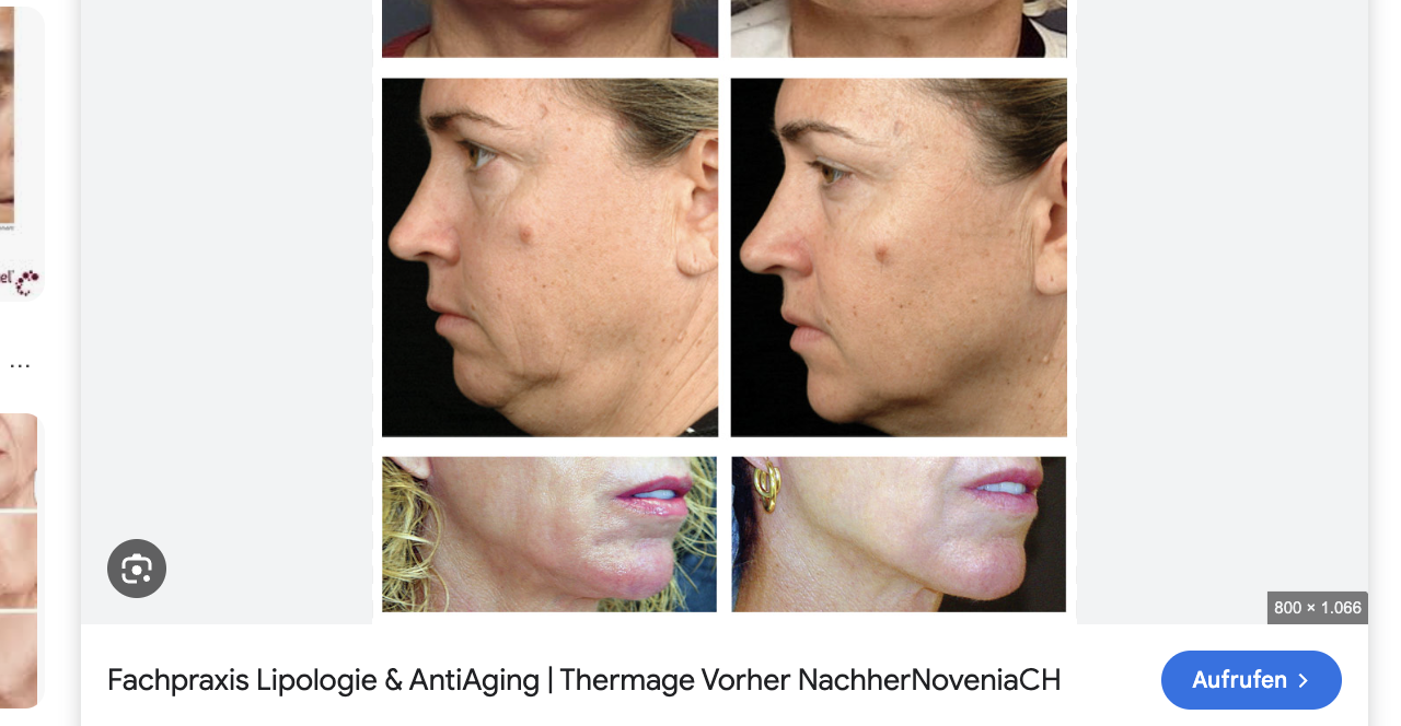 Jawline & unteres Gesicht, Profilansicht